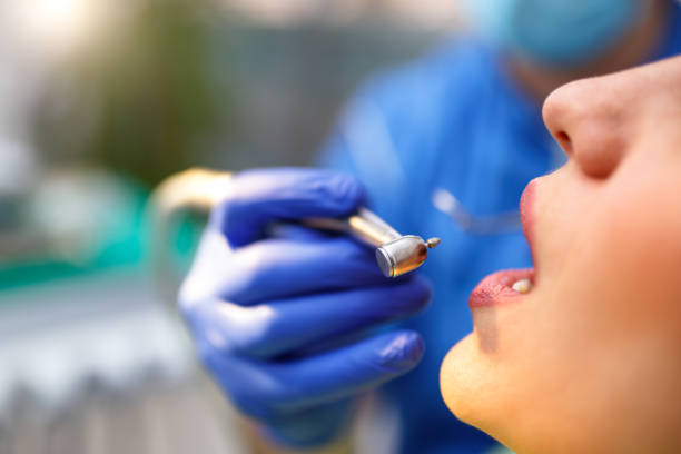 Best Teeth Whitening  in Cupertino, CA